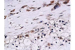 Formalin-fixed and paraffin embedded human placenta labeled with Anti-Cystatin B Polyclonal Antibody, Unconjugated (ABIN755692) at 1:200 followed by conjugation to the secondary antibody and DAB staining (CSTB antibody  (AA 51-98))