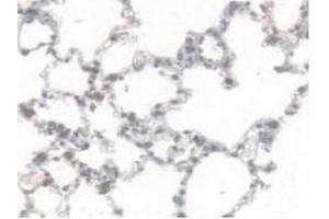IHC-P analysis of Rat Lung Tissue, with DAB staining. (CES1 antibody  (AA 19-300))