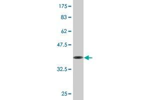 Western Blotting (WB) image for anti-erythrocyte Membrane Protein Band 4.2 (EPB42) (AA 623-721) antibody (ABIN515323)