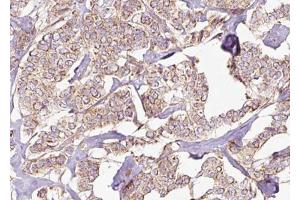 Immunohistochemistry (IHC) image for anti-Eukaryotic Translation Initiation Factor 2-alpha Kinase 3 (EIF2AK3) (C-Term) antibody (ABIN6264143)