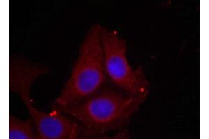 Immunofluorescence staining of methanol-fixed Hela cells using GAP43(Phospho-Ser41) Antibody. (GAP43 antibody  (pSer41))