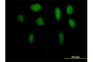 Immunofluorescence of purified MaxPab antibody to ZFP95 on HeLa cell. (ZKSCAN5 antibody  (AA 1-839))