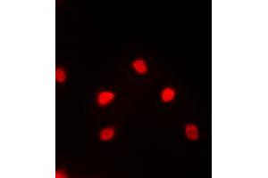 Immunofluorescent analysis of MEF2C staining in PC12 cells. (MEF2C antibody  (C-Term))