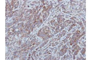 IHC-P Image Immunohistochemical analysis of paraffin-embedded A549 xenograft, using UNC13B, antibody at 1:500 dilution. (UNC13B antibody  (Internal Region))