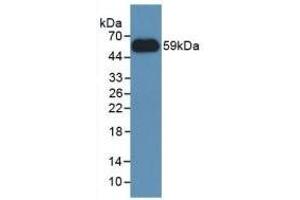 Detection of Recombinant NNMT, Human using Polyclonal Antibody to Nicotinamide-N-Methyltransferase (NNMT) (NNMT antibody  (AA 1-258))