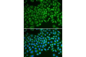 Immunofluorescence analysis of MCF-7 cells using SELE antibody.