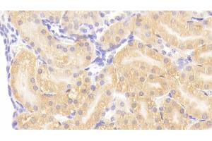 Detection of HSPBP1 in Mouse Kidney Tissue using Polyclonal Antibody to Heat Shock 70 kDa Binding Protein 1 (HSPBP1) (HSPBP1 antibody  (AA 209-354))