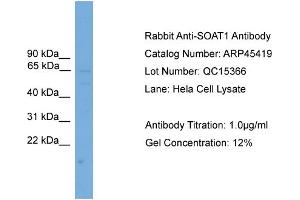 WB Suggested Anti-SOAT1  Antibody Titration: 0. (SOAT1 antibody  (Middle Region))