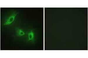 Immunofluorescence analysis of HeLa cells, using ACV1B Antibody. (Activin A Receptor Type IB/ALK-4 antibody  (AA 73-122))