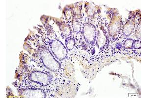 Formalin-fixed and paraffin embedded mouse small intestine tissue labeled with Anti-CT054/C20ORF54 Polyclonal Antibody, Unconjugated (ABIN754768) at 1:200 followed by conjugation to the secondary antibody and DAB staining