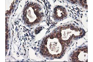 Immunohistochemical staining of paraffin-embedded Human breast tissue using anti-NUDT18 mouse monoclonal antibody.