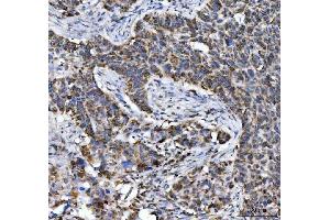 IHC analysis of Aconitase 2 using anti-Aconitase 2 antibody (ABIN7602770). (ACO2 antibody  (C-Term))