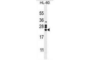 CSF2 Antibody (Center) western blot analysis in HL60 cell line lysates (35µg/lane). (GM-CSF antibody  (Middle Region))