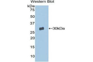 Western Blotting (WB) image for anti-Moesin (MSN) (AA 354-577) antibody (ABIN1859889) (Moesin antibody  (AA 354-577))