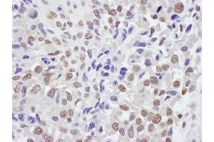 Immunohistochemistry (IHC) image for anti-Tripartite Motif Containing 33 (TRIM33) (AA 650-700) antibody (ABIN7453470) (TRIM33 antibody  (AA 650-700))