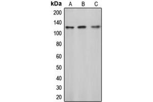 Western blot analysis of c-CBL (pY774) expression in Jurkat (A), mouse liver (B), rat liver (C) whole cell lysates.