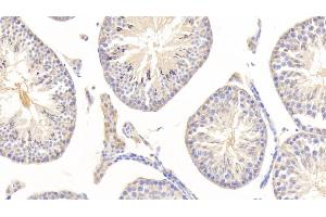 Detection of NSE in Mouse Testis Tissue using Polyclonal Antibody to Enolase, Neuron Specific (NSE) (ENO2/NSE antibody  (AA 2-434))