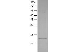 Western Blotting (WB) image for D-Dopachrome Tautomerase (DDT) (AA 1-118) protein (His tag) (ABIN7285904) (DDT Protein (AA 1-118) (His tag))