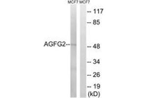 Western Blotting (WB) image for anti-ArfGAP with FG Repeats 2 (AGFG2) (AA 91-140) antibody (ABIN2890377)