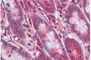 Human Small Intestine: Formalin-Fixed, Paraffin-Embedded (FFPE) (OCA2 antibody  (AA 468-517))