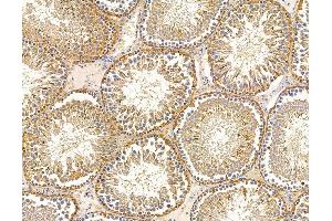 ABIN7095818 and ABIN7099880 at 1/100 staining rat testis tissue by IHC-P.