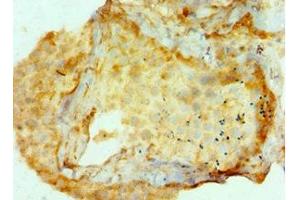 Immunohistochemistry of paraffin-embedded human testis tissue using ABIN7144327 at dilution of 1:100 (AMHR2 antibody  (AA 18-149))