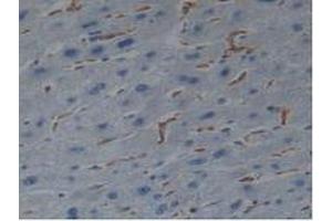 IHC-P analysis of Human Liver Tissue, with DAB staining. (Iba1 antibody  (AA 1-147))