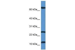 Western Blot showing TARP antibody used at a concentration of 1 ug/ml against Jurkat Cell Lysate (TARP antibody  (N-Term))