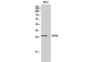 Western Blotting (WB) image for anti-CKLF-Like MARVEL Transmembrane Domain Containing 4 (CMTM4) (Internal Region) antibody (ABIN3174457) (CMTM4 antibody  (Internal Region))