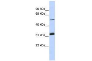 Image no. 1 for anti-Tandem C2 Domains, Nuclear (TC2N) (AA 251-300) antibody (ABIN6741190) (TC2N antibody  (AA 251-300))