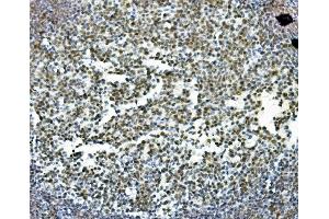IHC analysis of PRDM5 using anti-PRDM5 antibody (ABIN7600853).