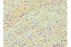 Immunohistochemistry of paraffin-embedded human epityphlon tissue using ABIN7162842 at dilution of 1:100 (FKBP4 antibody  (AA 220-459))