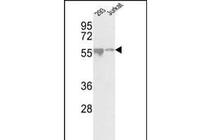 Western blot analysis of CDKL2 Center (ABIN391189 and ABIN2841281) in 293, Jurkat cell line lysates (35 μg/lane). (CDKL2 antibody  (AA 226-255))