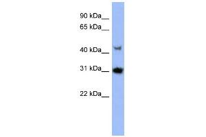 WB Suggested Anti-PRKY Antibody Titration: 0. (PRKY antibody  (N-Term))