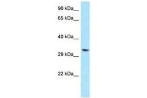 Image no. 1 for anti-TWIST Neighbor (TWISTNB) (AA 176-225) antibody (ABIN6747964) (TWIST Neighbor antibody  (AA 176-225))