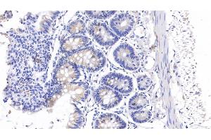 Detection of CEA in Rat Colon Tissue using Polyclonal Antibody to Carcinoembryonic Antigen (CEA) (CEA antibody  (AA 209-408))