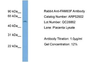 WB Suggested Anti-FAM83F  Antibody Titration: 0. (FAM83F antibody  (N-Term))