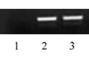 Histone H4 acetyl Lys5 antibody tested by ChIP analysis. (Histone H4 antibody  (acLys5))