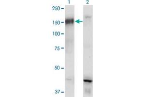 Western Blot analysis of BCR expression in transfected 293T cell line by BCR monoclonal antibody (M01), clone 2E5. (BCR antibody  (AA 182-280))