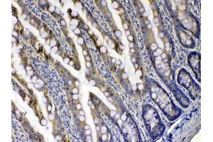 IHC analysis of Xanthine Oxidase using anti-Xanthine Oxidase antibody . (XDH antibody  (AA 2-343))