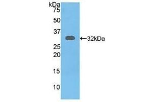 Detection of Recombinant RYK, Mouse using Polyclonal Antibody to Related To Receptor Tyrosine Kinase (RYK) (RYK antibody  (AA 287-533))