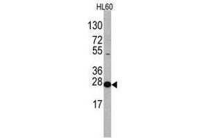Image no. 1 for anti-Eukaryotic Translation Initiation Factor 4E (EIF4E) (N-Term) antibody (ABIN357297) (EIF4E antibody  (N-Term))