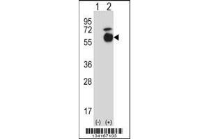 Western blot analysis of Acvr1 using rabbit polyclonal Mouse Acvr1 Antibody using 293 cell lysates (2 ug/lane) either nontransfected (Lane 1) or transiently transfected (Lane 2) with the Acvr1 gene. (ACVR1 antibody  (AA 137-166))