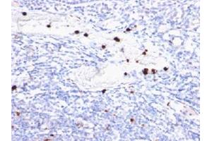 Immunohistochemical staining (Formalin-fixed paraffin-embedded sections) of human tonsil with MYADM monoclonal antibody, clone MYADM/972 .