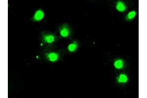 Image no. 1 for anti-Budding Uninhibited By Benzimidazoles 1 Homolog beta (Yeast) (BUB1B) antibody (ABIN1497002) (BUB1B antibody)