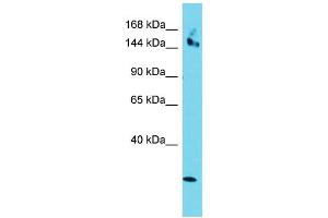 Host: Rabbit Target Name: CCDC141 Sample Type: HepG2 Whole Cell lysates Antibody Dilution: 1. (CCDC141 antibody  (Middle Region))
