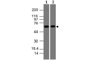 Image no. 1 for anti-SWAP Switching B-Cell Complex 70kDa Subunit (SWAP70) (AA 300-505) antibody (ABIN5027556) (SWAP70 antibody  (AA 300-505))