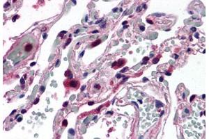 Anti-ELOVL5 antibody  ABIN1048538 IHC staining of human lung. (ELOVL5 antibody  (C-Term))