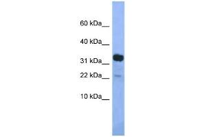 WB Suggested Anti-Klhdc9 Antibody Titration: 1. (KLHDC9 antibody  (Middle Region))
