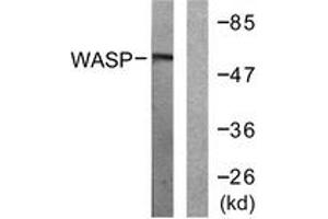 Western blot analysis of extracts from HepG2 cells, using WASP (Ab-290) Antibody. (WASP antibody  (AA 256-305))